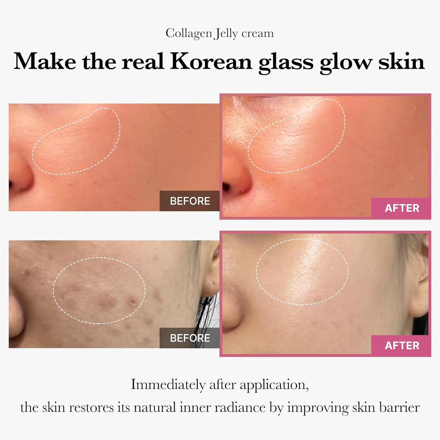 Pharmaelegance Medicube Collagen Jelly Cream – Korean Face Moisturizer for Uneven Skin Tone, Firmness & Glass Glow Skin | 110ml